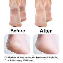Load image into Gallery viewer, Callus Remover Rechargeable Pedicure Tool for Dead Skin
