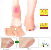 Load image into Gallery viewer, Anti Crack Silicone Half Gel Heel And Foot
